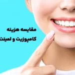 مقایسه هزینه کامپوزیت و لمینت دندان