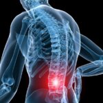 (ویدئو) تمرینات عالی جهت پیشگیری از کمر درد (ویدئو) تمرینات عالی جهت پیشگیری از کمر درد