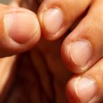 تأثیر یائسگی بر سلامت ناخن ها تأثیر یائسگی بر سلامت ناخن ها