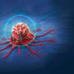 چه کسانی در معرض خطر ابتلا به سرطان روده هستند؟ چه کسانی در معرض خطر ابتلا به سرطان روده هستند؟