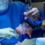 پیوند کلیه خوک به انسان در آمریکا مجوز گرفت پیوند کلیه خوک به انسان در آمریکا مجوز گرفت