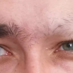 راهکاری که ابروهای ریخته را برمی‌گرداند