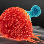 افزایش دو برابری آمار سرطان در ایران طی دو دهه آینده افزایش دو برابری آمار سرطان در ایران طی دو دهه آینده