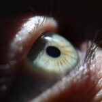 بازگرداندن بینایی به روشی عجیب؛ جراحان دندان بیمار کانادایی را در چشم او قرار میدهند! بازگرداندن بینایی به روشی عجیب؛ جراحان دندان بیمار کانادایی را در چشم او قرار میدهند!