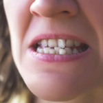 دلیل اصلی و علت لق شدن دندانها در بزرگسالی دلیل اصلی و علت لق شدن دندانها در بزرگسالی