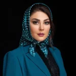 تغییر چهره لاله اسکندری بعد از عمل زیبایی مورد توجه قرار گرفت + ویدیو