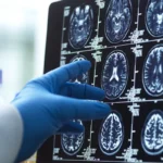 ۴ مرحله اصلی رشد مغز انسان؛ انسان‌ها تا ۳۲ سالگی «مثل نوجوان‌ها» فکر می‌کنند!