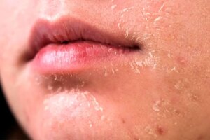 5 روش برای مراقبت از پوست در زمستان 5 روش برای مراقبت از پوست در زمستان