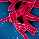 ۱.۲۳ میلیون نفر قربانی کشندهترین بیماری عفونی جهان در سال ۲۰۲۴ ۱.۲۳ میلیون نفر قربانی کشندهترین بیماری عفونی جهان در سال ۲۰۲۴