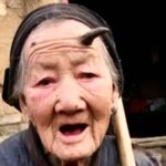 چرا بعضی انسانها «شاخ» درمیآورند؟ چرا بعضی انسانها «شاخ» درمیآورند؟