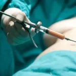 موج پشیمانی از عمل لیفت باسن برزیلی؛ چرا BBL پرریسک‌ترین جراحی ۲۰۲۵ شد؟