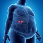 از «صورت ماه» تا «قوز بوفالو»: نشانه‌های آشکار و پنهان سندرم کوشینگ