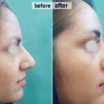 نمونه کارهای دکتر عتیقه چی در یزد نمونه کارهای دکتر عتیقه چی در یزد