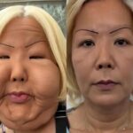 جراحی ترمیم چهره اینفلوئنسر معروف برزیلی پس از عمل زیبایی ناموفق در سال ۲۰۱۷