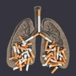 حتی کشیدن چند نخ سیگار در روز خطر نارسایی قلبی را ۵۰ درصد افزایش می‌دهد!