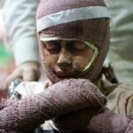 قیمت لباس سوختگی ۲ تا ۴۰ میلیون تومان