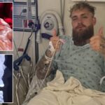 ژست میلیونی جیک پاول پس از شکست سنگین در برابر آنتونی جاشوا و جراحی فک ژست میلیونی جیک پاول پس از شکست سنگین در برابر آنتونی جاشوا و جراحی فک