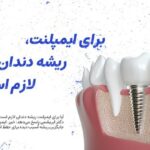 آیا برای ایمپلنت، ریشه دندان لازم است؟