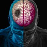 چگونه زمستان خطر سکته مغزی را افزایش می‌دهد؟