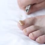 دلایل ابتلا به قارچ ناخن دلایل ابتلا به قارچ ناخن