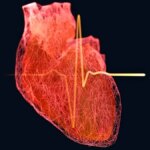 خطر بیماری قلبی در مردان از ۳۵ سالگی آغاز می‌شود