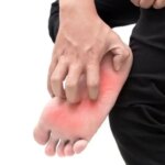 خارش کف پا؛ مشکل کوچک یا نشانه بیماری جدی؟