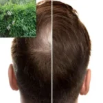 درمان طبیعی طاسی با یک گیاه اسرارآمیز چینی